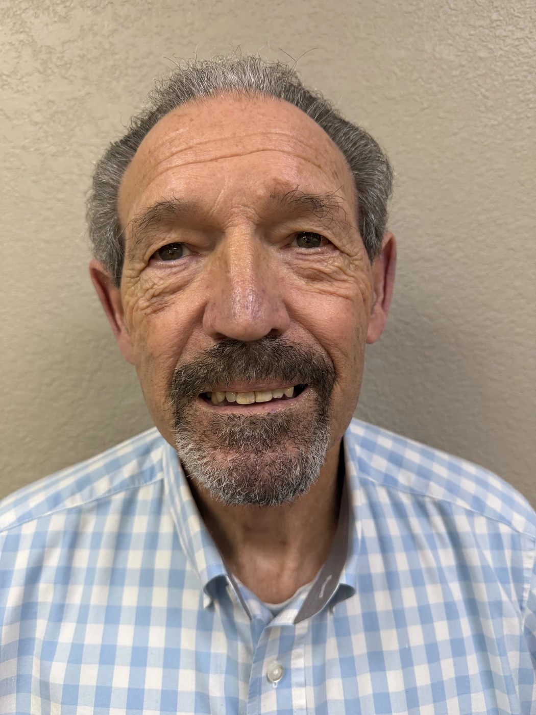 Before full-arch dental implant treatment, patient case 02